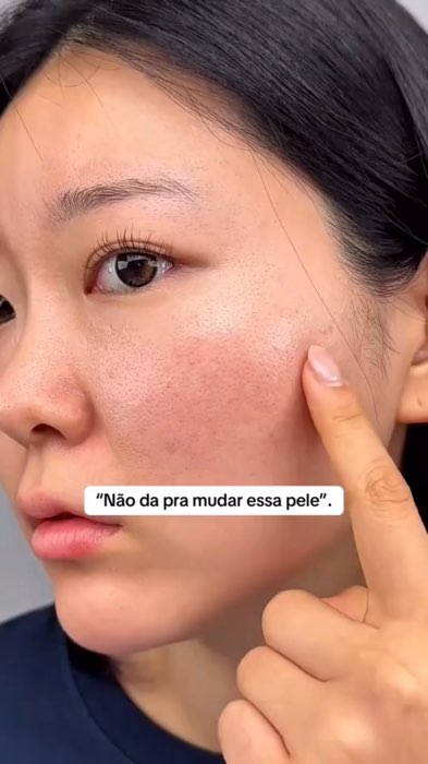 Sérum PDRN #espermadesalmao #antirugas #antiidade #serumfacial